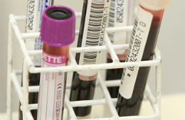 Imagem: Coleta de sangue foi necessária para investigação de cromossomos