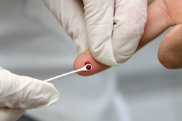 Imagem: Dedo sendo furado para testagem rápida de HIV, com gota de sangue aparecendo
