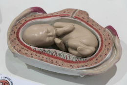 Imagem: Reprodução de um feto humano dentro da barriga da mãe (Foto: Viktor Braga/UFC)