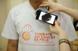 Imagem: O câncer de pele é o tipo da doença mais incidente no Brasil (Foto: Fernando Frazão/AbR)