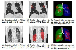 Imagens de tomografias de pulmão