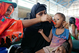 Imagem: Criança com sinais de desnutrição vivendo em área de refugiados em Bangladesh, um dos países que teve crianças na amostra da pesquisa (Foto: Mallika Panorat/União Europeia)