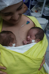 Mãe segurando dois bebês prematuros na posição do método canguru