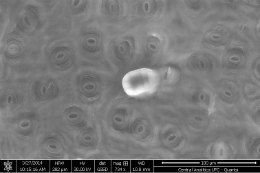 Imagem: Imagem de microscopia eletrônica da superfície da folha de um cajueiro mostrando estômatos e um tricoma secretor (Fonte: Central Analítica da UFC)