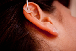 Imagem: A auriculoterapia é um tipo de acupuntura em pontos das orelhas, sem a utilização de agulhas (Foto: Ministério da Saúde)
