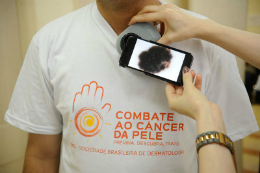 Imagem: Diagnóstico precoce é essencial no combate ao câncer de pele (Foto: Fernando Frazão/ABR)