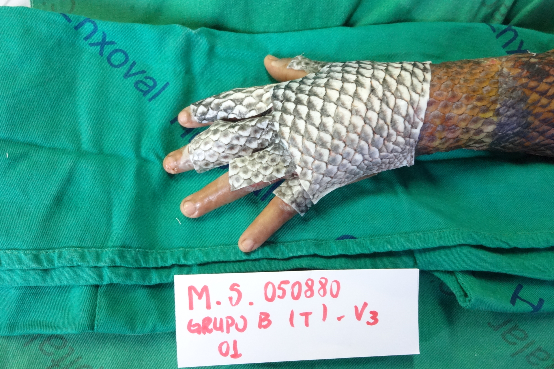 Foto de uma mão coberta com pele de tilápia