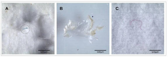 Imagem: fotos de microplásticos encontrados nos peixes