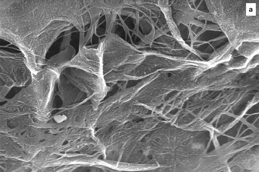 Imagem: Microscopia eletrônica (aumento de 50.000 vezes) mostra as fibras de celulose entrelaçadas com óxido de grafeno ancorado com nanopartículas de prata