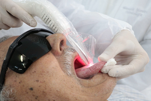 Imagem: Paciente com a língua para fora, enquanto enfermeiro aplica laser