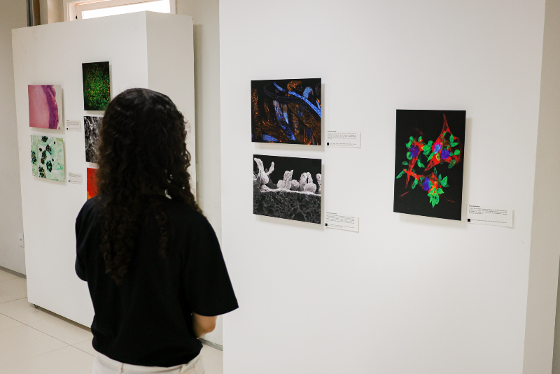 Imagem: A imagem retrata a abertura da exposição "Arte sob o Microscópio", promovida pela Universidade Federal do Ceará (UFC). Em destaque, uma visitante observa atentamente as obras expostas em uma galeria de paredes brancas. As imagens apresentadas são resultado de registros científicos feitos com microscopia eletrônica e outras técnicas de ampliação, revelando a beleza estética presente no mundo microscópico — como formas, texturas e cores de microrganismos, células e tecidos.  As obras têm aspecto visual marcante: algumas com colorações vibrantes e formas abstratas, outras em preto e branco, remetendo ao detalhamento técnico. Cada imagem está acompanhada por uma pequena legenda descritiva, indicando seu conteúdo científico e autor ou laboratório de origem.  O ambiente da exposição é limpo, iluminado e propício à contemplação, unindo arte e ciência de maneira acessível ao público. A proposta da mostra é revelar como a investigação científica também pode ser uma forma de expressão visual e de admiração estética, aproximando o conhecimento acadêmico da sociedade.